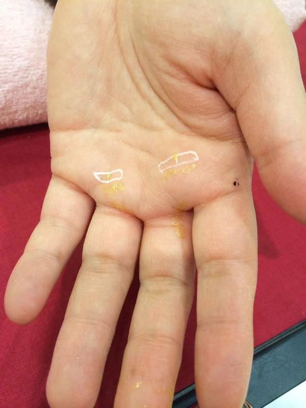 古代療法_レイキ体験施術会で腰痛と首の痛みの解消施術例_4