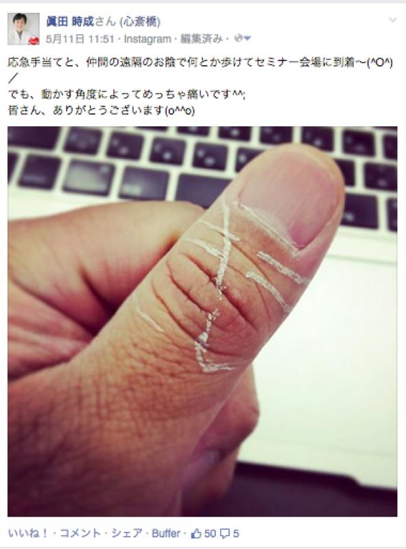 3古代療法-レイキ+移し身療法・古代アロマ療法の施術例-肉離れの応急手当