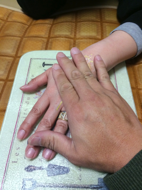 広島-腰や下腹部の違和感や痛みを放っておいたら歩けなくなった-腰痛改善事例8