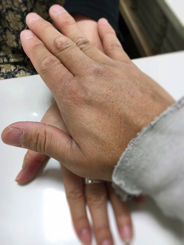 6金銀の癒やし-古代療法で腰痛の解消_松山市内-ジョープラ_