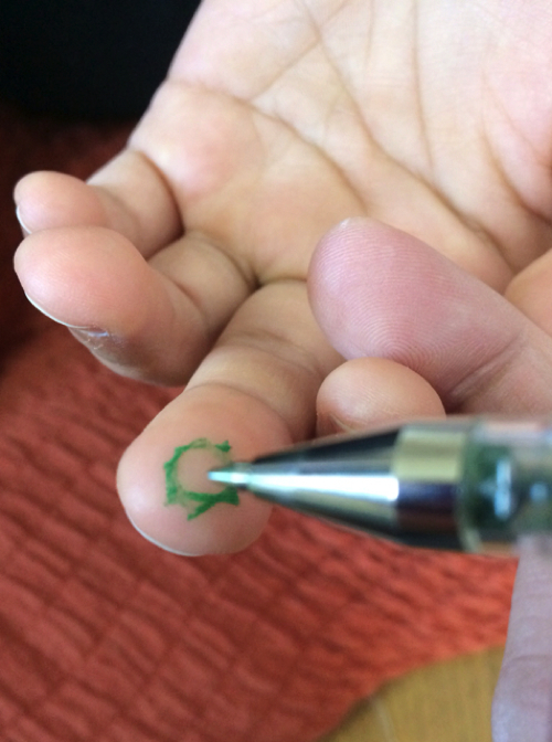 子どもの花粉症の鼻水をとめて頭痛を解消するおまじない4