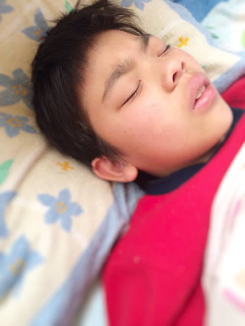 子どもの花粉症の鼻水をとめて頭痛を解消するおまじない1