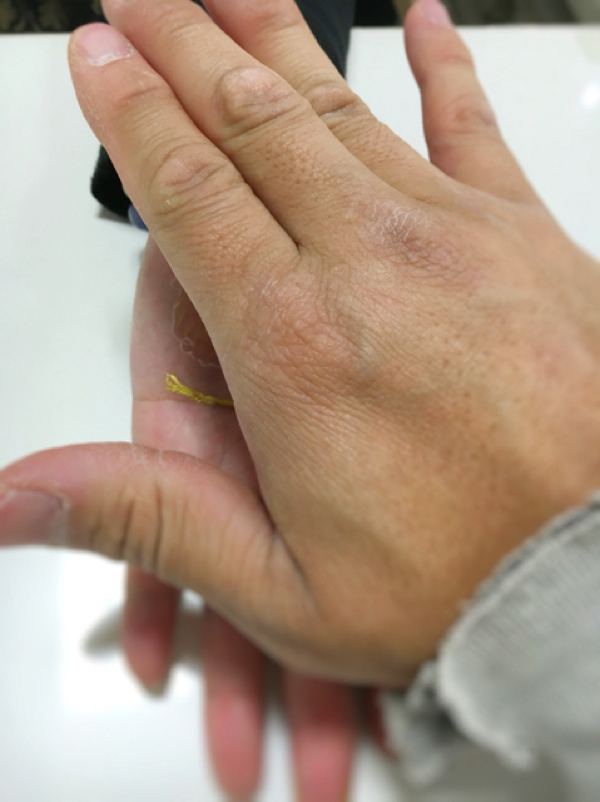 7金銀の癒やし-古代療法で腰痛の解消_松山市内-ジョープラ_