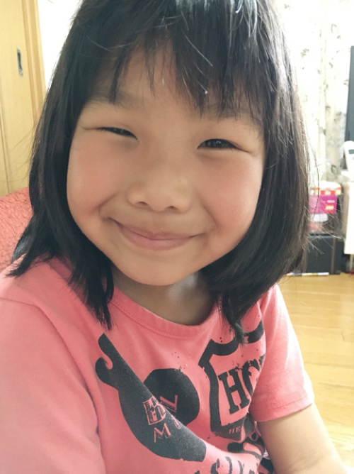 虫刺されの痒みと晴れを一発解消するおまじない1