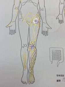 膝の激痛を解消